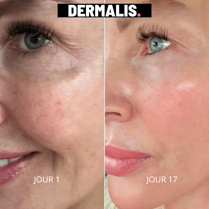 PACK DERMALIS 270 | Masque de Luminothérapie Pro