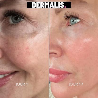 PACK DERMALIS 270 | Masque de Luminothérapie Pro